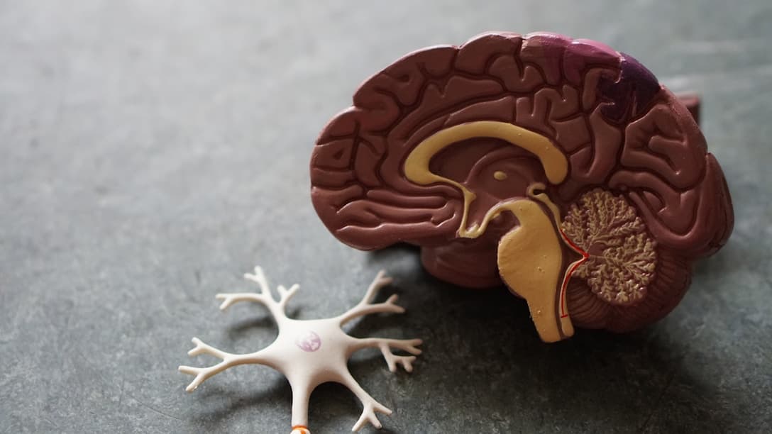 Mind Care - AI-Powered Alzheimer's Support System